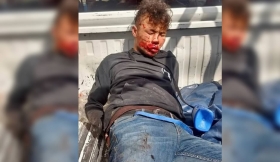 As&iacute; lo dejaron, pobladores amenazaron con hacer justicia por propia mano